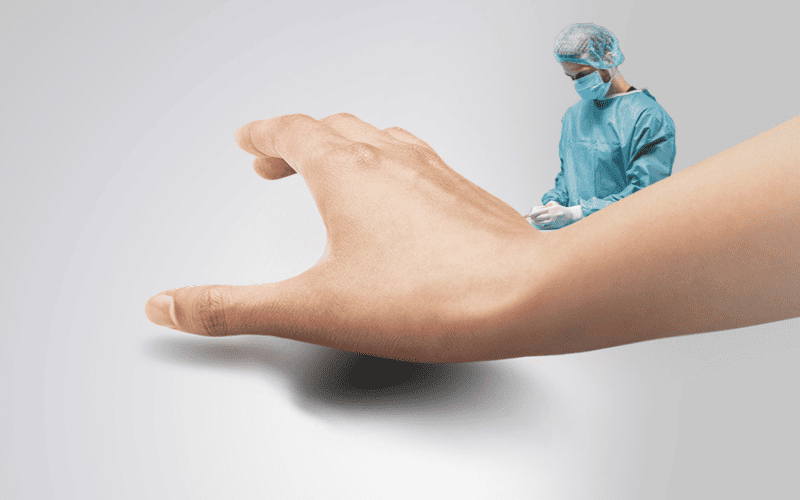 El Cerrahisi ve Mikrocerrahi - Op. Dr. Sercan Karadeniz Trabzon